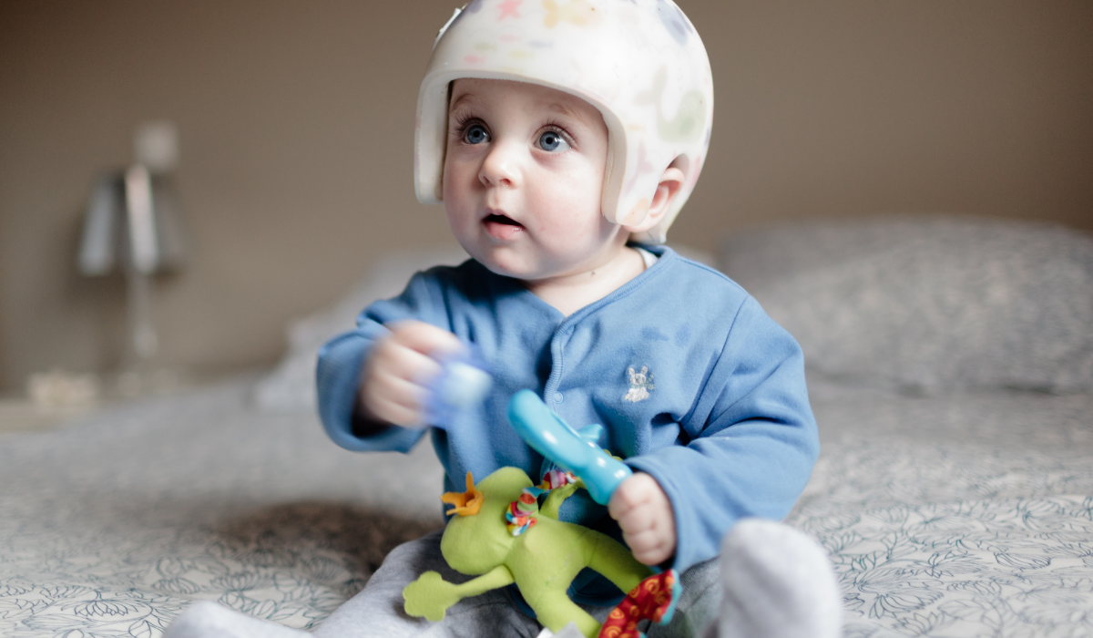 photo of baby wearing a molding helmet playing with plastic toy